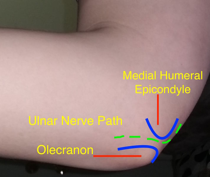 File:Ulnar Elbow.jpg