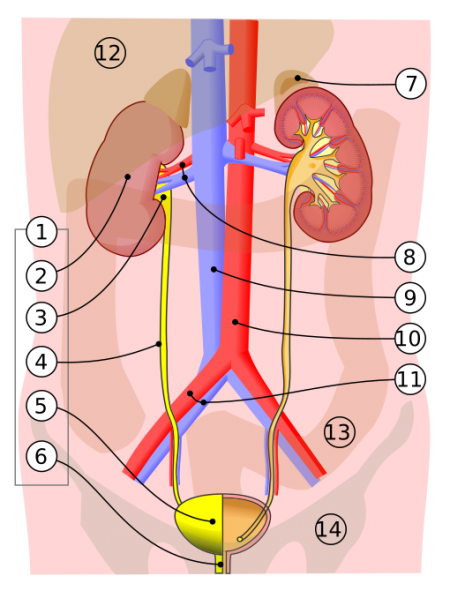 Urolithiasis - WikEM
