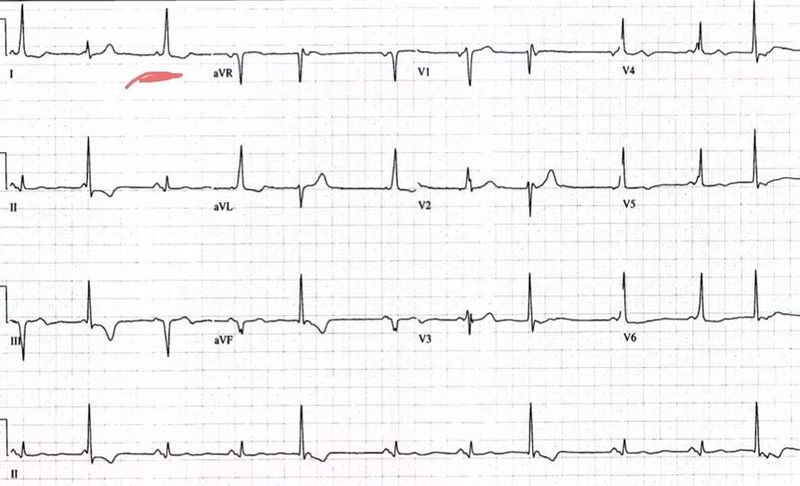 File:WPW and PJC.JPG